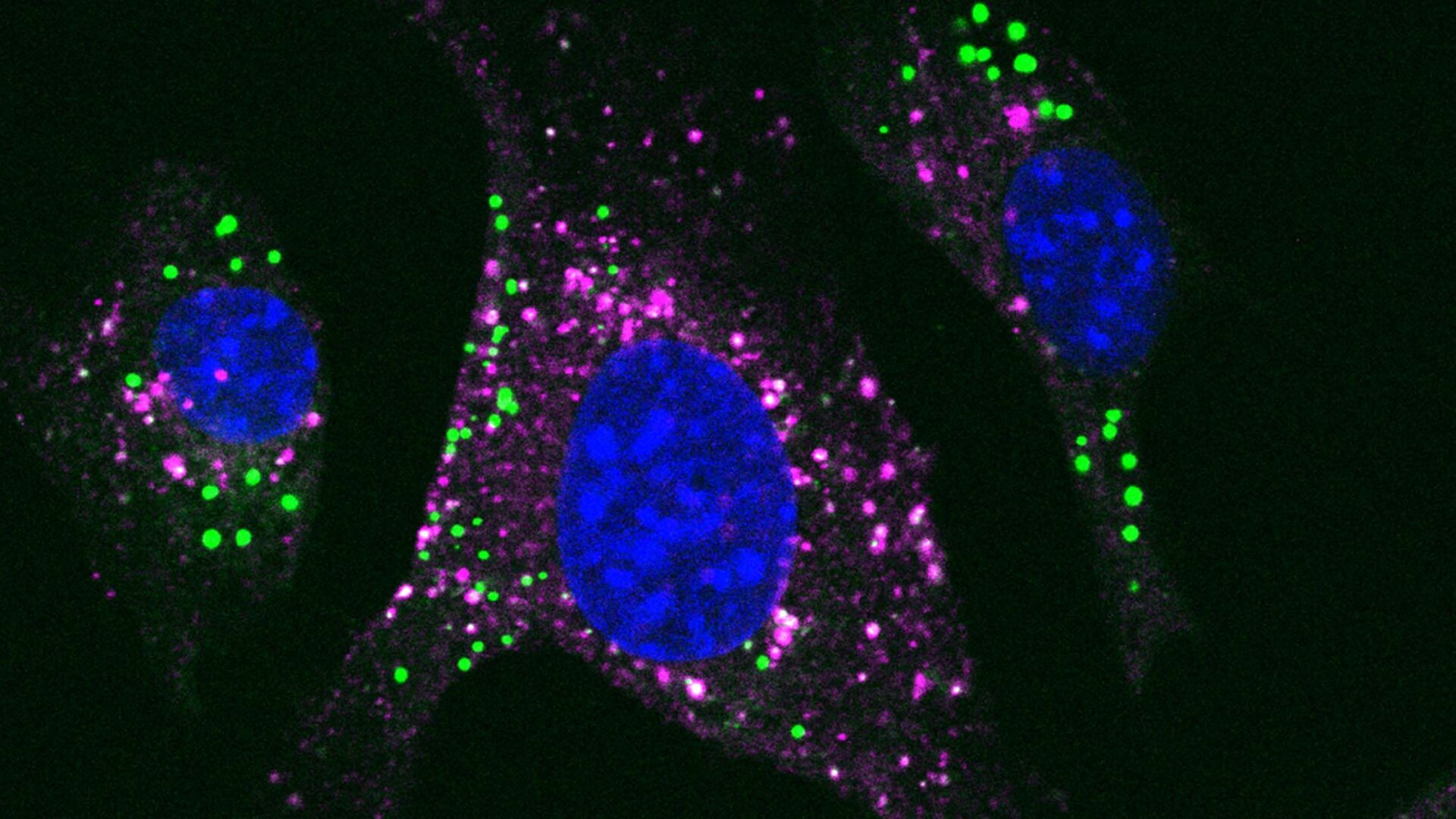 Endothelial Cells