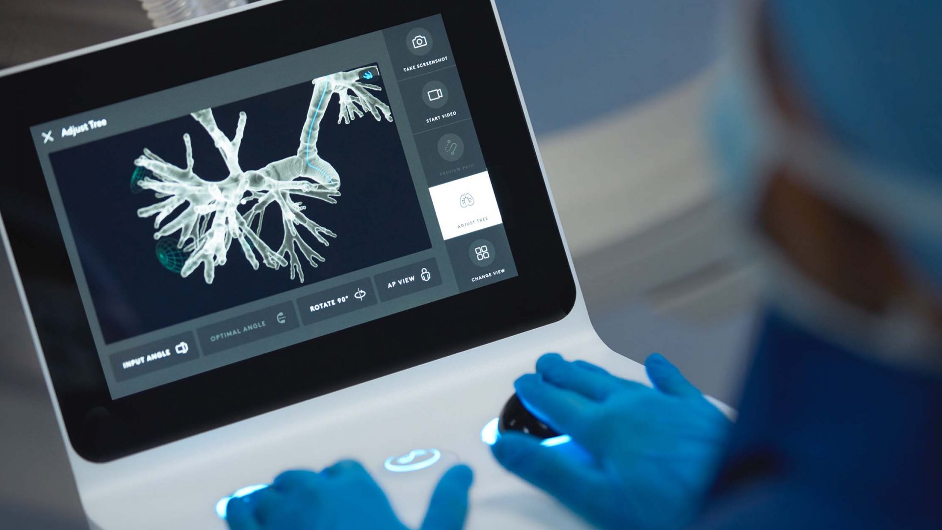 Doctor Viewing Robotic Bronchoscopy Imaging Results