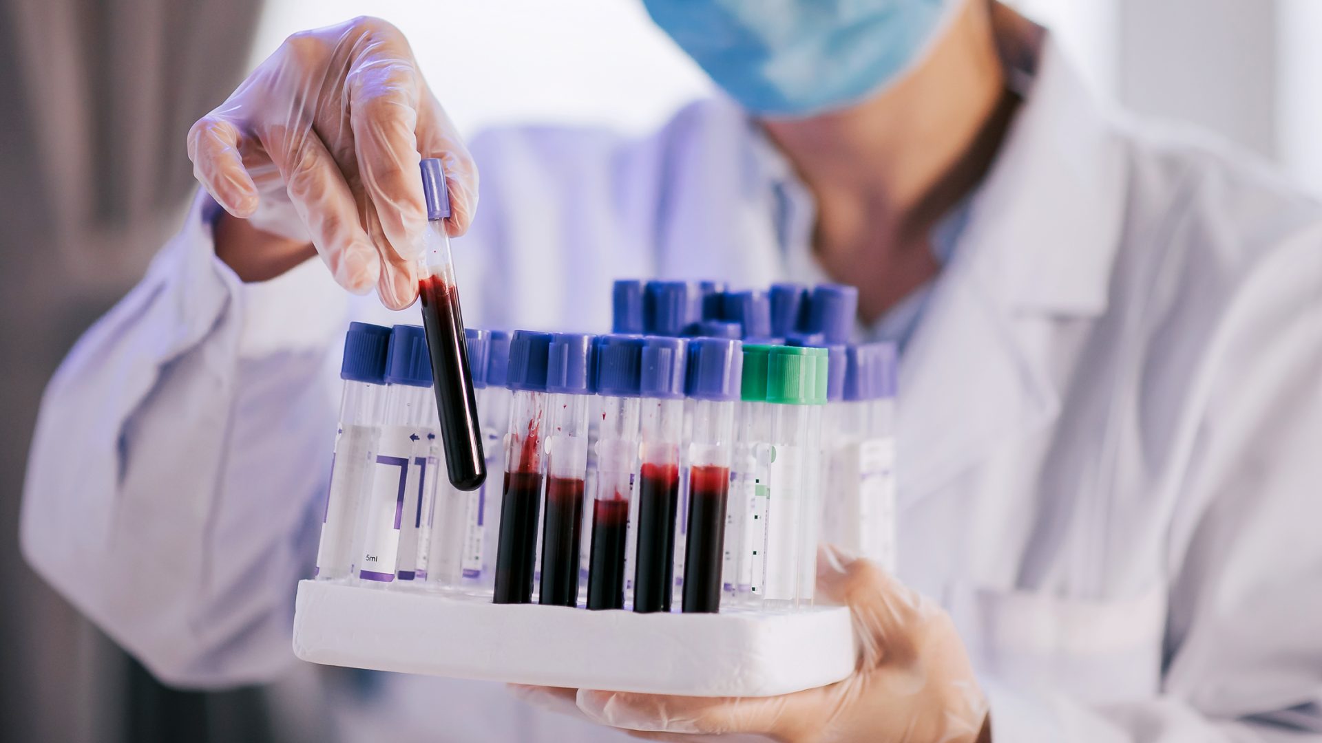 Researcher Holding Rack of Test Tubes with Blood Samples