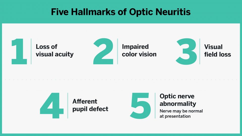 Research has established five main clinical findings that point to optic neuritis in patients.