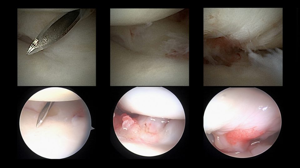 Internal views of a wrist during surgical procedure