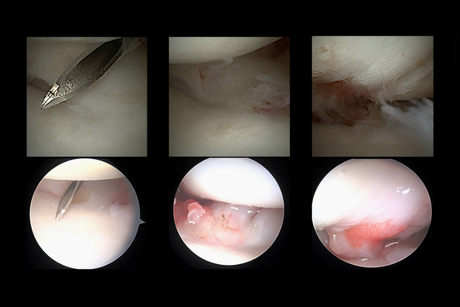 Internal views of a wrist during surgical procedure