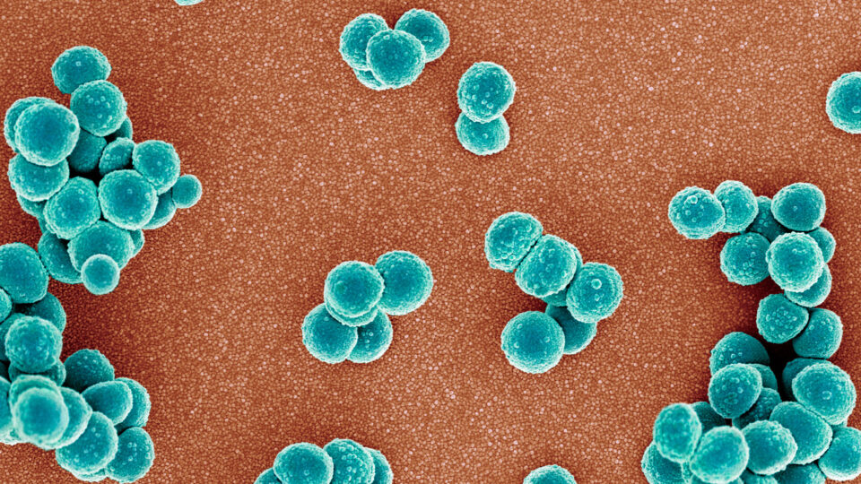 Staphylococcus aureus. Source: Getty Images