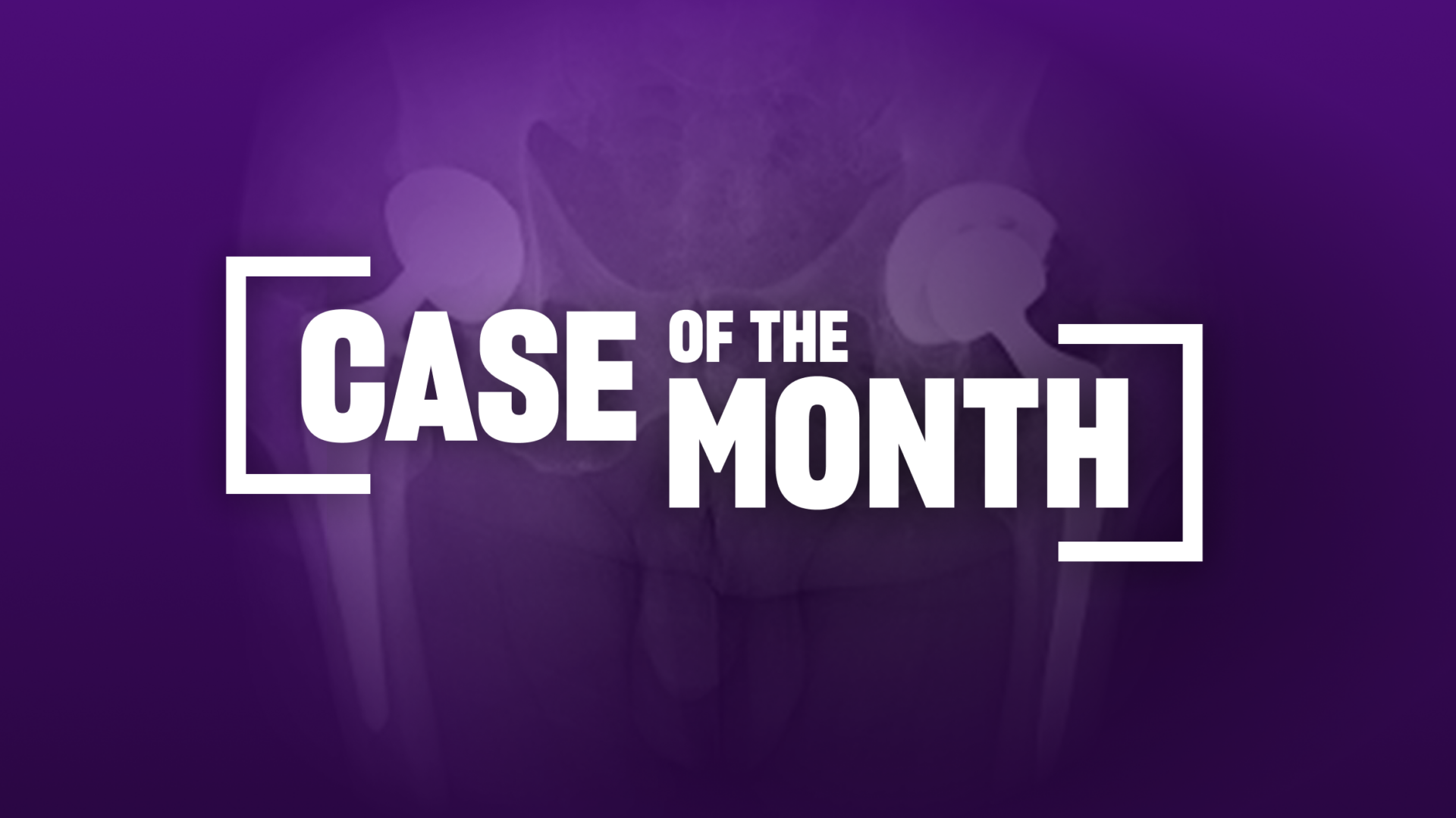 Case of the Month graphic.